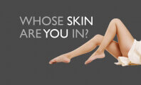 Whose Skin Are You In?