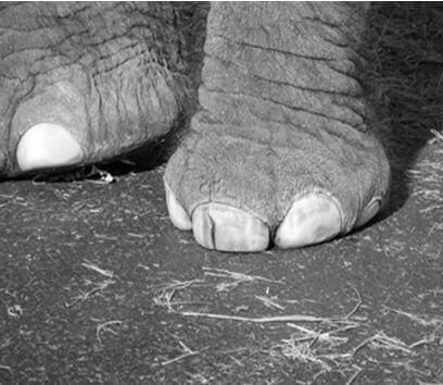 Karen_Split_Toenail_2007