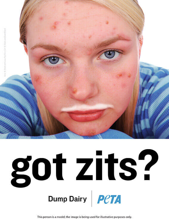 "Got Zits?" Anti-Dairy Ad 2015