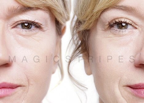 PETA-Approved Eyelid Lift Makes Waves in the Plastic Surgery World