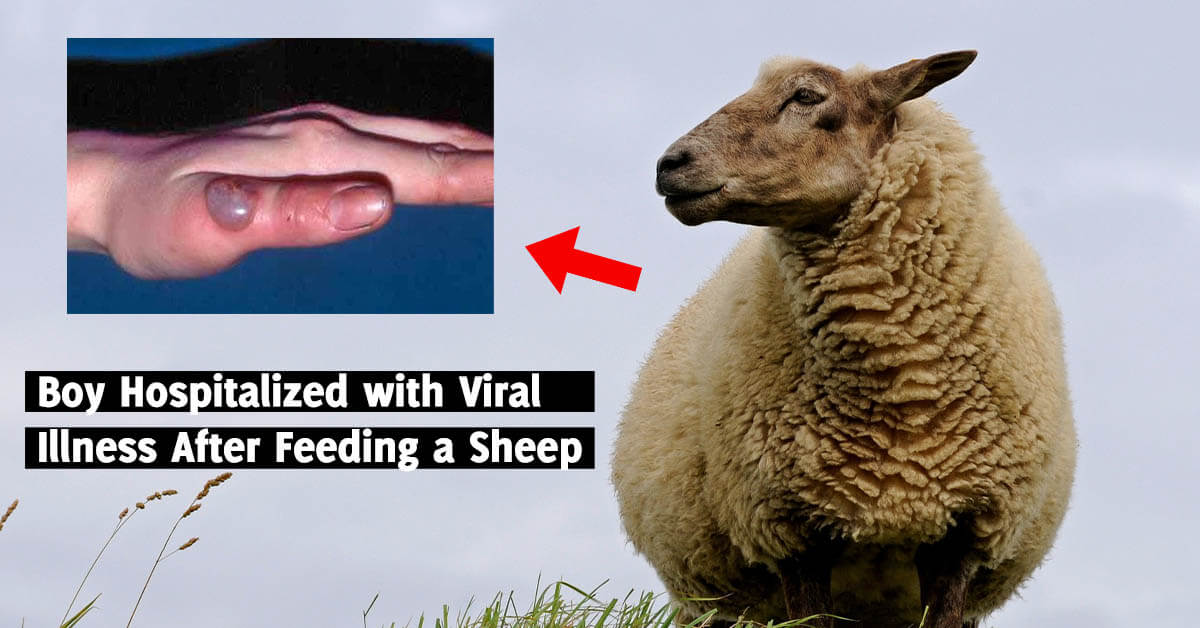 Disease Of Cattle And Sheep And Passed To Humans Pregnancy Depression