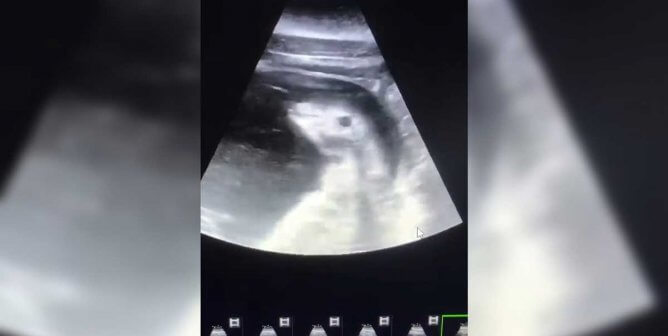 PETA: Birth of Beluga Whale at SeaWorld San Antonio Is Nothing to Celebrate