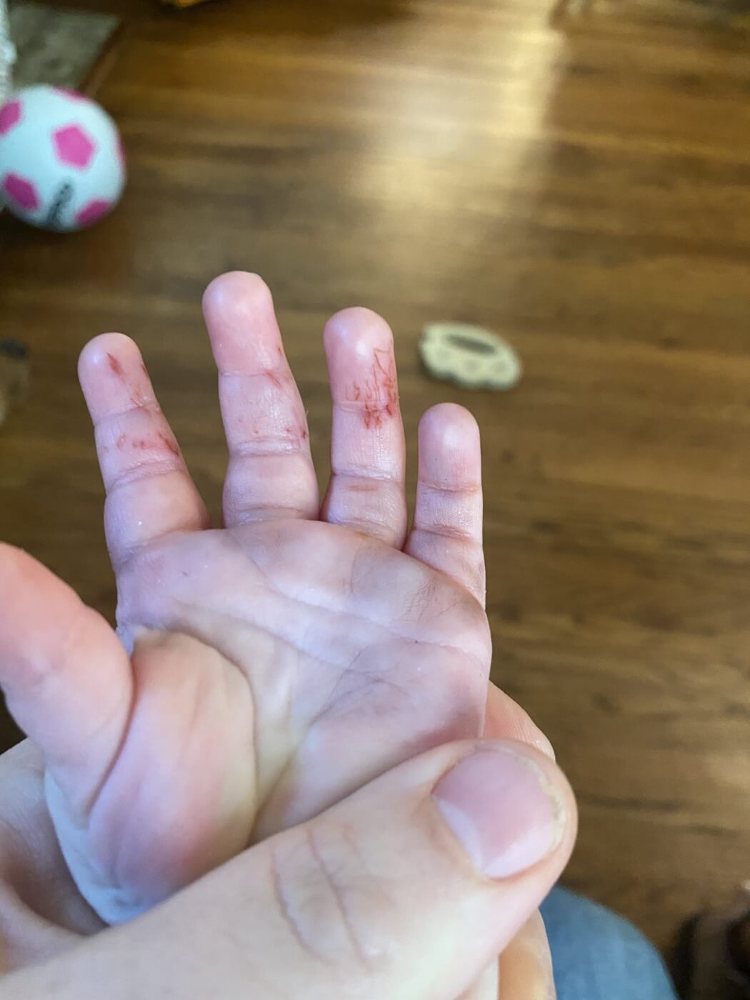 Seaquest: Baby's hand bitten by fish