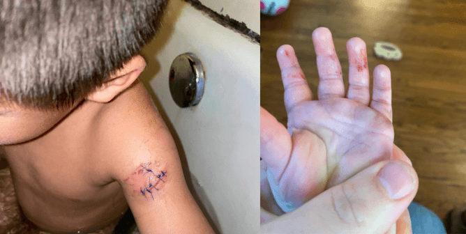 PETA Files FTC Complaint Over Injuries to Visitors, Staff at SeaQuest Aquariums