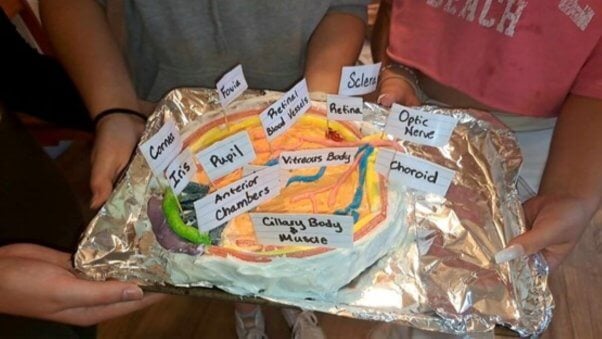 Eyeball dissection diorama cake on tray with labels