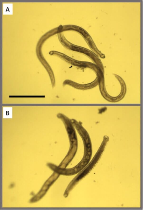 Aroian deliberately infects animals with hookworms (pictured here), roundworms, and whipworms.